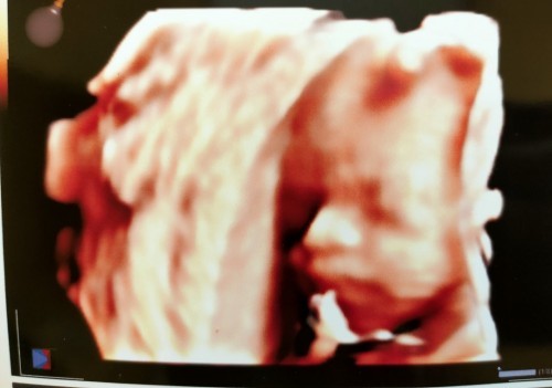 Yuk... Sharing masuk Trisemester 3