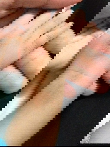 Cara mengatasi dan mengobati