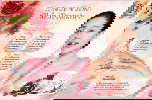 Xin ý kiến các mom