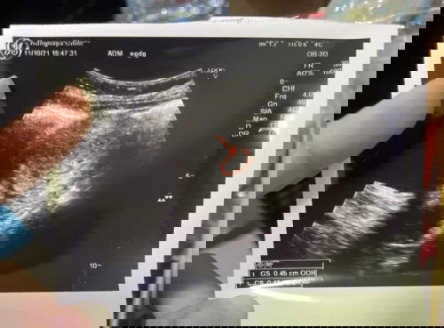 สวัสดีค่ะ ขอปรึกษาแม่ๆ ซาวด์ไม่พบอะไร