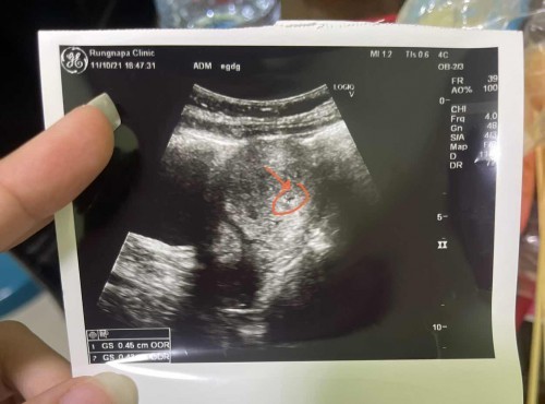 สวัสดีค่ะ ขอปรึกษาแม่ๆ ซาวด์ไม่พบอะไร