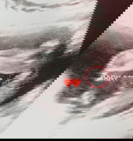 Boleh tolong tengok boy ke girl?