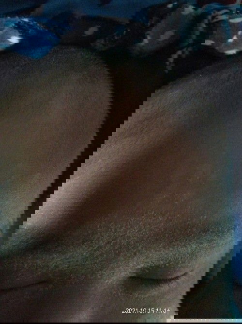 Bun anak saya pergantian kulit kok seperti ini ya ?