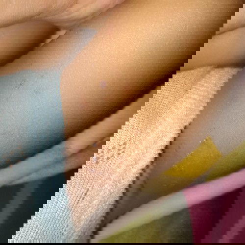 Assalamualaikum, slamat siang bun. Mau tnya apakah kulit sperti ini biasa trjadi sama bayi? Trimksih