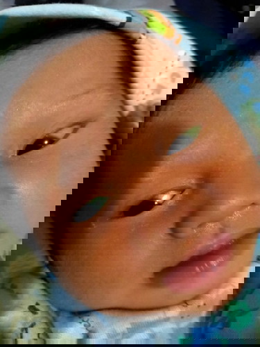 Bunda? mohon saranya untuk bayi saya yg kuning ini udah 7 hari π