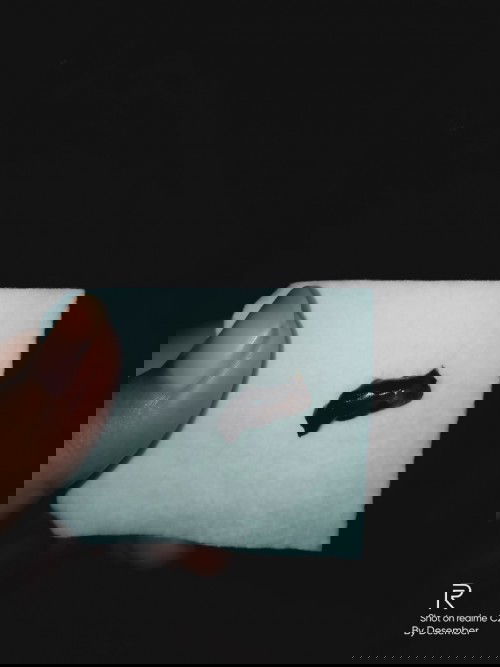 Hamil muda keluar flek