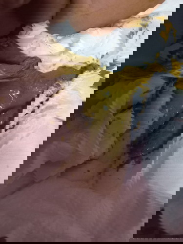 น้องสองเดือนอึเป็นสีเขียวเหลว