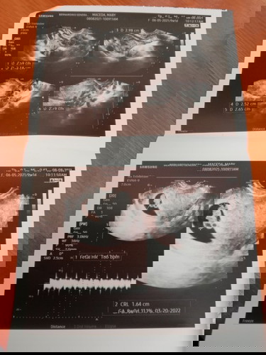 Pregnancy journey