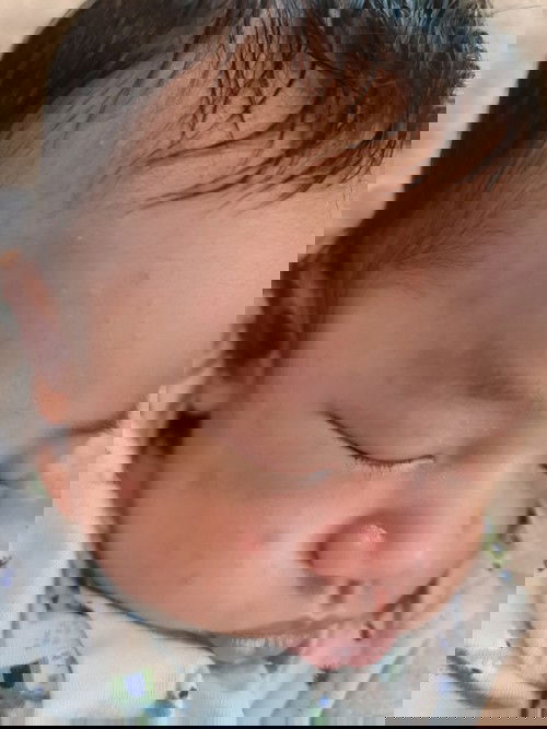 ต้าวน้อย ขึ้น ผื่นสิวทารก (คิดว่า) ควรใช้ครีมหรือโลชั่น ยี่ห้อไหนดีคะ ?