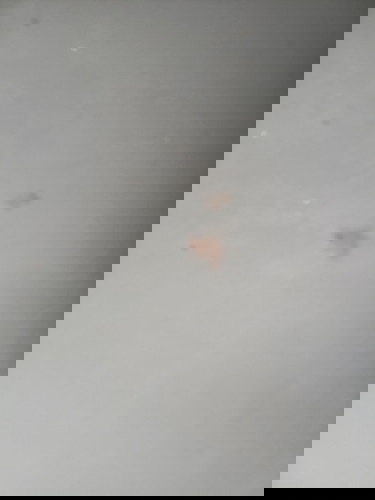 SPOTTING SANA PO MASAGOT ANG TANONG KO KINAKABAHAN PO KASI AKO SA SPOTTING NA NANGYAYARI SAKIN NGAUN
