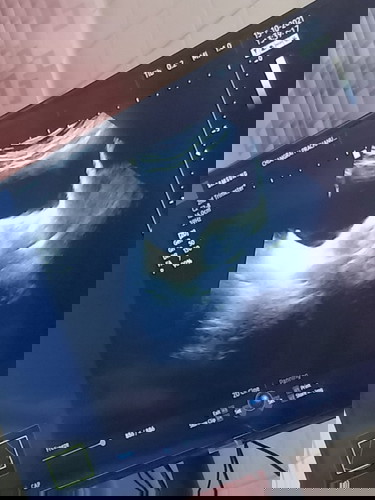 4 w ปกติไหมค่ะ