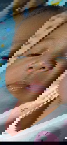 ปากลูกสีเเบบนี้ปกติมั้ย