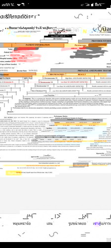 ตรวจน้องดาวน์