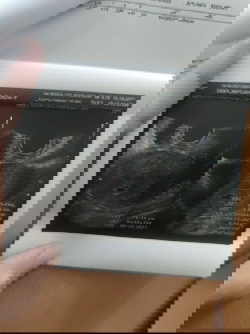 Any similar experience?