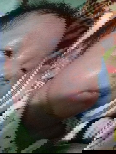 Hay momy.aku mau tanyak nih.babyku umur 1 bln..muncul bintik2 putih..