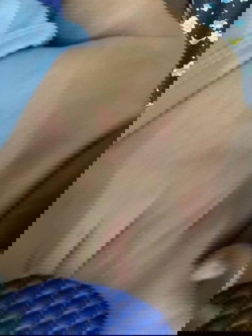 bintik merah di punggung