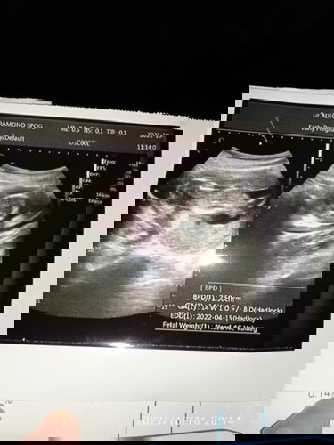 Bun mau nanya di usia kandungan 13w kok belum dengar detak jantungnya.