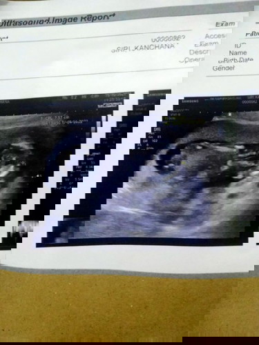 มีแม่ๆบ้านใหนพอจะดูออกมั้ยคะว่าญ.รึช.