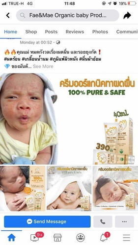 fae&mae ทาผดผื่น มีแม่ๆคนไหนเคยซื้อมาทาให้ลูกไหมคะ