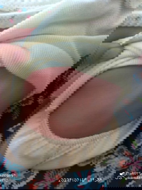 Punggung belakanh menonjol ketika duduk