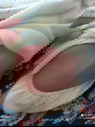 Punggung belakanh menonjol ketika duduk