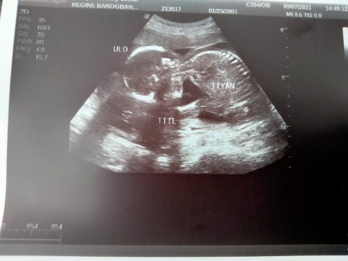 Baby Girl Name