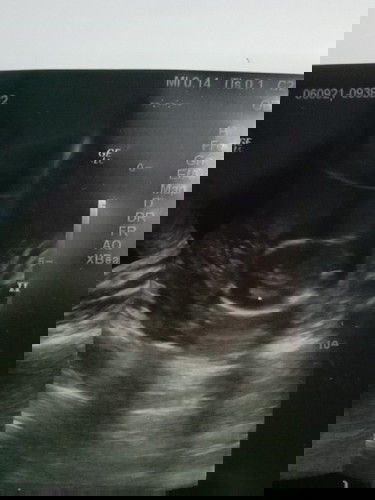 ช รึ ญ 😅???