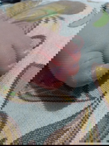 Pagbabalat ng daliri sa paa