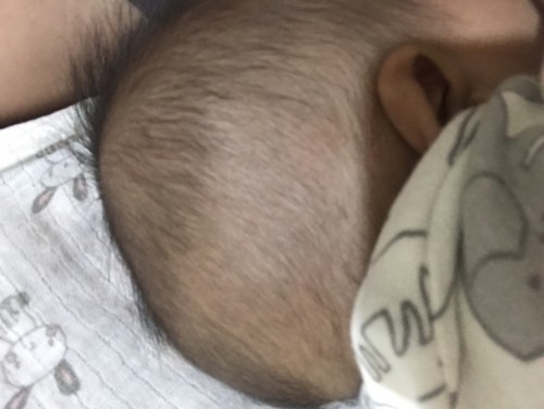 หัวลูกโนอันตรายหรือเปล่า
