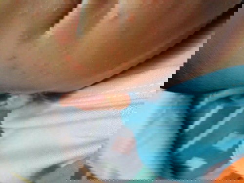 OBAT RUAM UNTUK SI KECIL