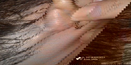 Benjolan kecil keras jika dipegang dibelakang telinga