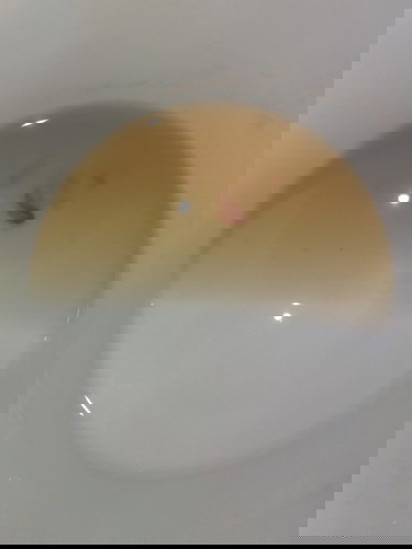 Bkt po may ganto sa ihi ko