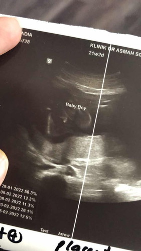 Jantina baby berubah tak?