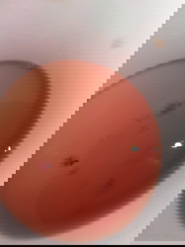 Bakit po ganto ang aking ihi