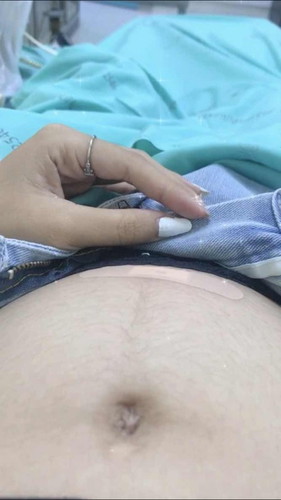 เจาะสายสะดือ