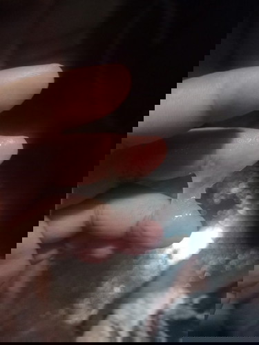 32 weeks Vaginal Discharge