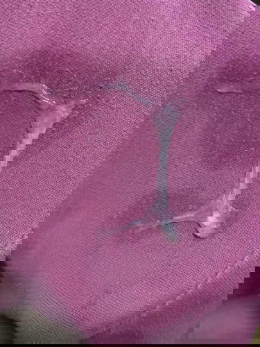 37+2 ค่ะ มีมูกใสแบบนี้ต้องไปหาหมอเลย/หาคะ