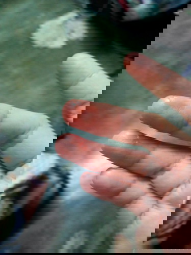 เลือดออกตอนนี้ทำอะไรไม่ถูกเลย