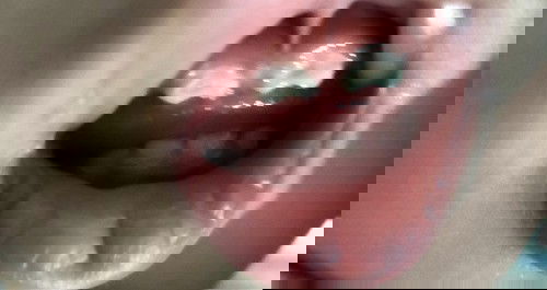 My baby's teeth look terrible. Is it normal?