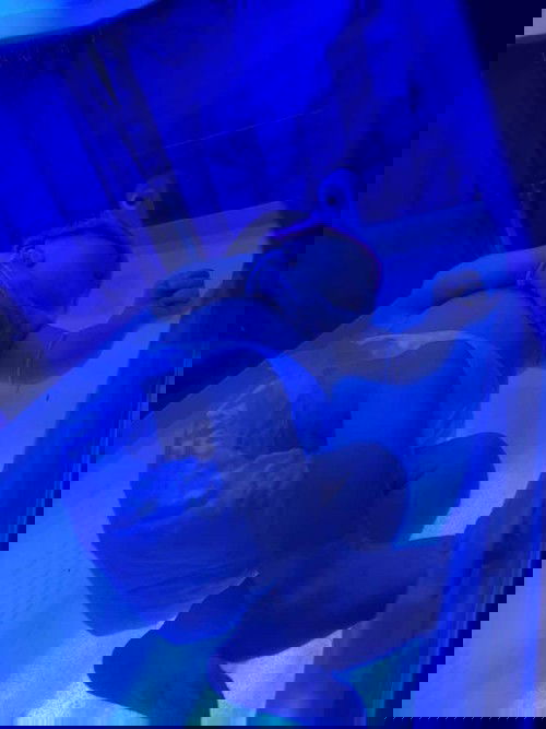 ค่าเหลือง 15.7