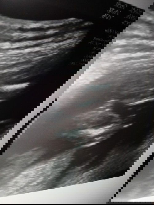 ช่วยดูเพศน้องหน่อยจ้า