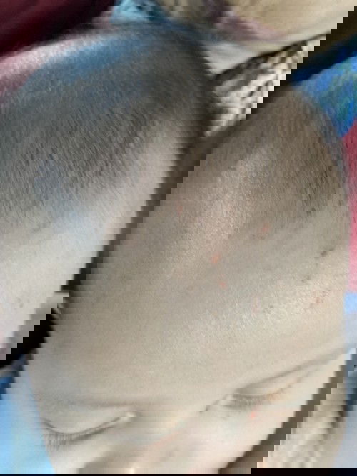 Menghilangkan luka cakar