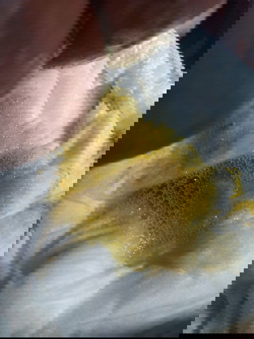 น้องถ่ายเหลวเป็นมูก (ไม่มีเลือด)