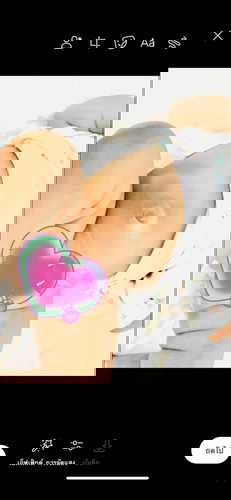 สะดือลูกใครเป็นแบบนี้บ้างคะ คุณแม่กังวลมากค่ะ