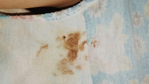 Sorry po s picture.dhil lng po kya ito sa ie?pa 38weeks n po ako 1cm narin po .no sign labor