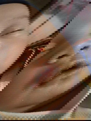 Bibir seiring waktu berwarna gelap