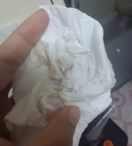 ตกขาวมีสีน้ำตาลตอนตั้งท้อง เกิดจากอะไรคะ แล้วอันตรายไหมคะ