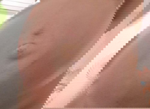 มีแม่ๆคนไหนท้องเป็น​แบบนี้บ้างคะ