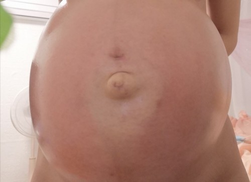 มีแม่ๆคนไหนท้องเป็นแบบนี้บ้างคะ