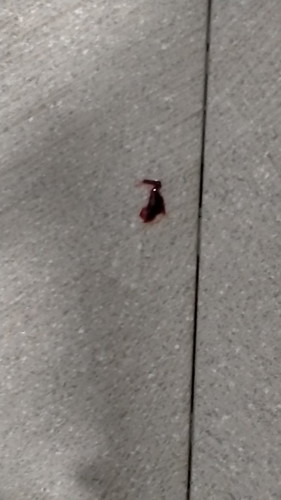 8 weeks pregnant bleeding after sex normal po ba ito mga mam, respect my question pls,